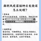 疫情期间普通发烧怎么办/疫情期间发烧了咋办