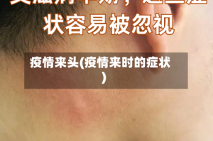 疫情来头(疫情来时的症状)