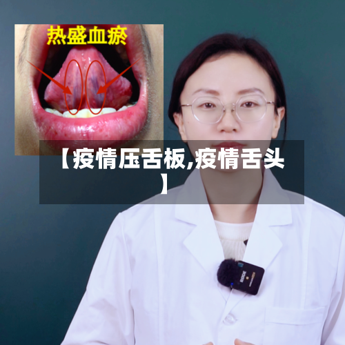 【疫情压舌板,疫情舌头】-第1张图片