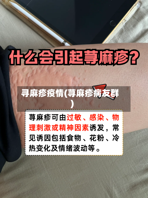 寻麻疹疫情(荨麻疹病友群)-第2张图片