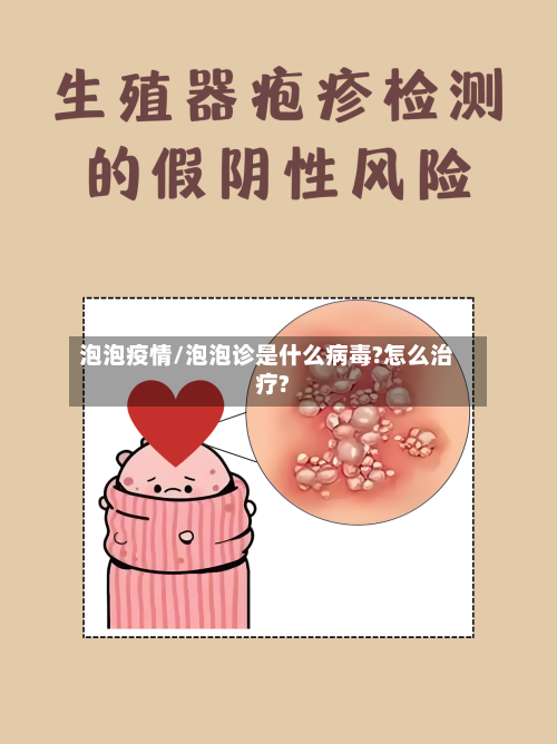 泡泡疫情/泡泡诊是什么病毒?怎么治疗?-第2张图片