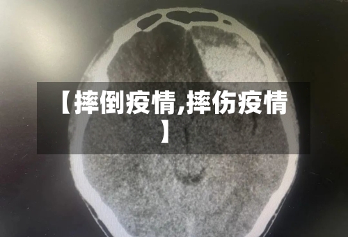 【摔倒疫情,摔伤疫情】-第1张图片