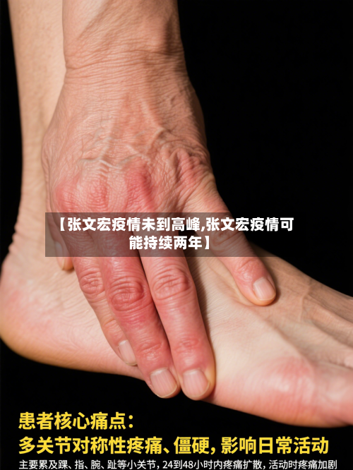 【张文宏疫情未到高峰,张文宏疫情可能持续两年】-第1张图片